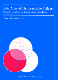 EEG Atlas of Photosensitive Epilepsy Studied Using Low-luminance Visual Stimulation